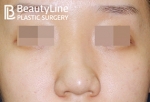 Beauty Line Plastic Surgery,Reviews,Images, Promotions — Korea cost, reviews & before-after | MISOODA