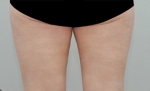 Glovi Plastic Surgery, Reviews, Images, Promotions, Dr. Rho Bongil, Dr. Nam Sangjae, Dr. Park Jongchul — Korea cost, reviews & before-after | MISOODA