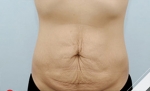 Glovi Plastic Surgery, Reviews, Images, Promotions, Dr. Rho Bongil, Dr. Nam Sangjae, Dr. Park Jongchul — Korea cost, reviews & before-after | MISOODA