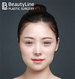 Beauty Line Plastic Surgery,Reviews,Images, Promotions — Korea cost, reviews & before-after | MISOODA
