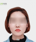 GYALUMHAN Plastic Surgery,Reviews,Images, Promotions — Korea cost, reviews & before-after | MISOODA