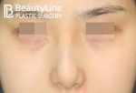 Beauty Line Plastic Surgery,Reviews,Images, Promotions — Korea cost, reviews & before-after | MISOODA