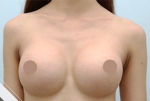 Glovi Plastic Surgery, Reviews, Images, Promotions, Dr. Rho Bongil, Dr. Nam Sangjae, Dr. Park Jongchul — Korea cost, reviews & before-after | MISOODA