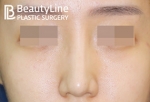 Beauty Line Plastic Surgery,Reviews,Images, Promotions — Korea cost, reviews & before-after | MISOODA