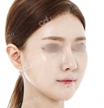facial contouring