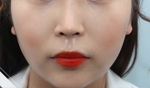 Glovi Plastic Surgery, Reviews, Images, Promotions, Dr. Rho Bongil, Dr. Nam Sangjae, Dr. Park Jongchul — Korea cost, reviews & before-after | MISOODA