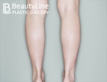Beauty Line Plastic Surgery,Reviews,Images, Promotions — Korea cost, reviews & before-after | MISOODA