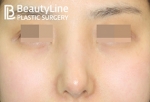 Beauty Line Plastic Surgery,Reviews,Images, Promotions — Korea cost, reviews & before-after | MISOODA