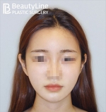 Beauty Line Plastic Surgery,Reviews,Images, Promotions — Korea cost, reviews & before-after | MISOODA