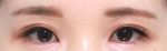 GYALUMHAN Plastic Surgery,Reviews,Images, Promotions — Korea cost, reviews & before-after | MISOODA