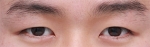 GYALUMHAN Plastic Surgery,Reviews,Images, Promotions — Korea cost, reviews & before-after | MISOODA