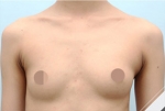 Glovi Plastic Surgery, Reviews, Images, Promotions, Dr. Rho Bongil, Dr. Nam Sangjae, Dr. Park Jongchul — Korea cost, reviews & before-after | MISOODA