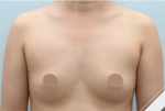 Glovi Plastic Surgery, Reviews, Images, Promotions, Dr. Rho Bongil, Dr. Nam Sangjae, Dr. Park Jongchul — Korea cost, reviews & before-after | MISOODA