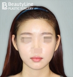 Beauty Line Plastic Surgery,Reviews,Images, Promotions — Korea cost, reviews & before-after | MISOODA
