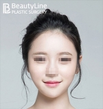 Beauty Line Plastic Surgery,Reviews,Images, Promotions — Korea cost, reviews & before-after | MISOODA