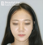 Beauty Line Plastic Surgery,Reviews,Images, Promotions — Korea cost, reviews & before-after | MISOODA
