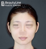 Beauty Line Plastic Surgery,Reviews,Images, Promotions — Korea cost, reviews & before-after | MISOODA