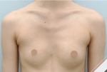 Glovi Plastic Surgery, Reviews, Images, Promotions, Dr. Rho Bongil, Dr. Nam Sangjae, Dr. Park Jongchul — Korea cost, reviews & before-after | MISOODA