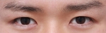 GYALUMHAN Plastic Surgery,Reviews,Images, Promotions — Korea cost, reviews & before-after | MISOODA