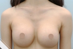 Glovi Plastic Surgery, Reviews, Images, Promotions, Dr. Rho Bongil, Dr. Nam Sangjae, Dr. Park Jongchul — Korea cost, reviews & before-after | MISOODA