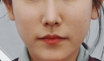 Glovi Plastic Surgery, Reviews, Images, Promotions, Dr. Rho Bongil, Dr. Nam Sangjae, Dr. Park Jongchul — Korea cost, reviews & before-after | MISOODA