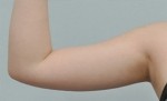 Glovi Plastic Surgery, Reviews, Images, Promotions, Dr. Rho Bongil, Dr. Nam Sangjae, Dr. Park Jongchul — Korea cost, reviews & before-after | MISOODA