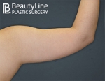 Beauty Line Plastic Surgery,Reviews,Images, Promotions — Korea cost, reviews & before-after | MISOODA