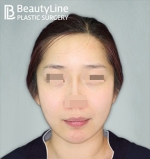 Beauty Line Plastic Surgery,Reviews,Images, Promotions — Korea cost, reviews & before-after | MISOODA
