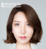 Beauty Line Plastic Surgery,Reviews,Images, Promotions — Korea cost, reviews & before-after | MISOODA