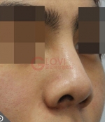 Glovi Plastic Surgery, Reviews, Images, Promotions, Dr. Rho Bongil, Dr. Nam Sangjae, Dr. Park Jongchul — Korea cost, reviews & before-after | MISOODA