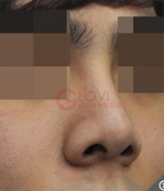 Glovi Plastic Surgery, Reviews, Images, Promotions, Dr. Rho Bongil, Dr. Nam Sangjae, Dr. Park Jongchul — Korea cost, reviews & before-after | MISOODA