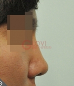 Glovi Plastic Surgery, Reviews, Images, Promotions, Dr. Rho Bongil, Dr. Nam Sangjae, Dr. Park Jongchul — Korea cost, reviews & before-after | MISOODA