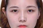 GYALUMHAN Plastic Surgery,Reviews,Images, Promotions — Korea cost, reviews & before-after | MISOODA