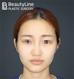 Beauty Line Plastic Surgery,Reviews,Images, Promotions — Korea cost, reviews & before-after | MISOODA