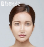 Beauty Line Plastic Surgery,Reviews,Images, Promotions — Korea cost, reviews & before-after | MISOODA
