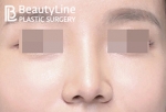 Beauty Line Plastic Surgery,Reviews,Images, Promotions — Korea cost, reviews & before-after | MISOODA