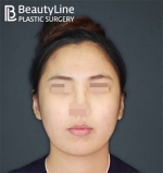 Beauty Line Plastic Surgery,Reviews,Images, Promotions — Korea cost, reviews & before-after | MISOODA