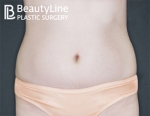 Beauty Line Plastic Surgery,Reviews,Images, Promotions — Korea cost, reviews & before-after | MISOODA