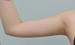 Glovi Plastic Surgery, Reviews, Images, Promotions, Dr. Rho Bongil, Dr. Nam Sangjae, Dr. Park Jongchul — Korea cost, reviews & before-after | MISOODA