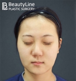 Beauty Line Plastic Surgery,Reviews,Images, Promotions — Korea cost, reviews & before-after | MISOODA