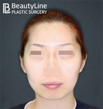 Beauty Line Plastic Surgery,Reviews,Images, Promotions — Korea cost, reviews & before-after | MISOODA