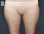 Beauty Line Plastic Surgery,Reviews,Images, Promotions — Korea cost, reviews & before-after | MISOODA
