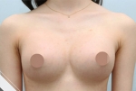 Glovi Plastic Surgery, Reviews, Images, Promotions, Dr. Rho Bongil, Dr. Nam Sangjae, Dr. Park Jongchul — Korea cost, reviews & before-after | MISOODA