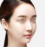 facial contouring
