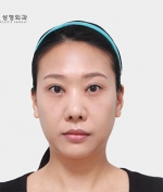 GYALUMHAN Plastic Surgery,Reviews,Images, Promotions — Korea cost, reviews & before-after | MISOODA