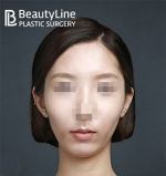 Beauty Line Plastic Surgery,Reviews,Images, Promotions — Korea cost, reviews & before-after | MISOODA