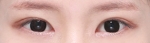 GYALUMHAN Plastic Surgery,Reviews,Images, Promotions — Korea cost, reviews & before-after | MISOODA