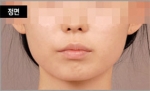 NJH Plastic Surgery,Reviews,Images, Promotions — Korea cost, reviews & before-after | MISOODA