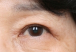 NJH Plastic Surgery,Reviews,Images, Promotions — Korea cost, reviews & before-after | MISOODA