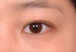 NJH Plastic Surgery,Reviews,Images, Promotions — Korea cost, reviews & before-after | MISOODA